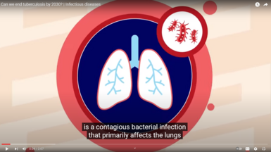 Cover of the animation: Can we end TB by 2023?